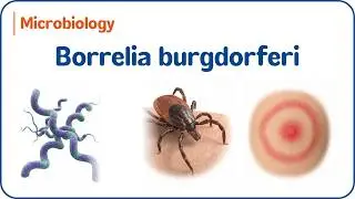 25. Borrelia burgdorferi 🦠 Болезнь Лайма, сыпь и диагностика | USMLE и NEET-PG