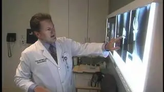 What causes pleurisy