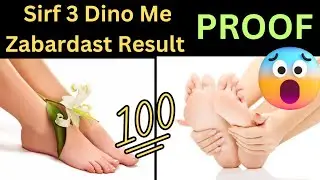 फटी एड़ियों से पाए छूटकारा||7 days foot cream ||