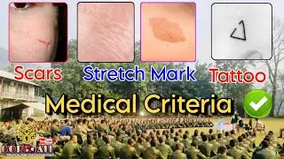 Tattoo, Scars, Birth Mark, Stretch Mark Criteria in British and Singapore Selection // GORKHALI
