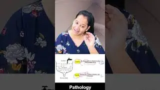 1 minute learning:    Incidence and Prevalence