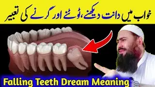 Khwab mein dant tootna ki tabeer | Khwab mein dant tootna | Khwab mein dant girna | Khwab Ki Tabeer
