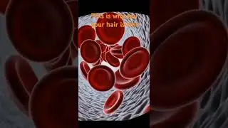 This is the reason for your thin hair #hairstyle #hair #hairgrowthhack #hairloss #hair #shorts