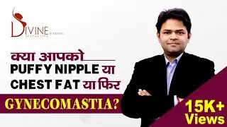 क्या आपको Puffy Nipple या Chest Fat या फिर Gynecomastia है? | Gyno or Chest Fat