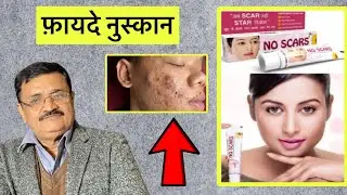 No Scar क्रीम के Side effects कैसे हटाएं| how to remove side effects| fairness| free pimples face