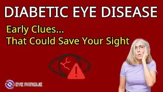 Diabetic Eye Disease: Early Warning Signs & Prevention Tips