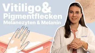 Wieso bekommt man Vitiligo? Was sind Pigmentflecken? │Dr. med. Alice Martin
