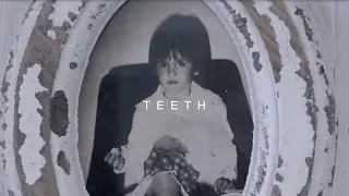 Sorry Mom - Teeth (Official Music Video)