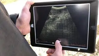 Easi Scan Go ultrasound