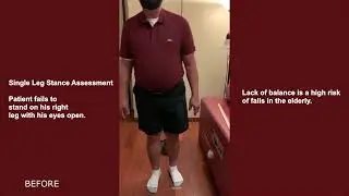 Hip pain & Balance problem