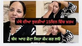 ਮੱਥੇ ਦੀਆਂ ਝੁਰੜੀਆਂ 15 ਦਿਨ ਵਿੱਚ ਗਾਇਬ,Wrinkle free forehead in 15days