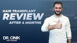 Hair Transplant Review After 4 Months | Hair Transplant | Dr. Emrah Cinik