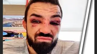 Mike Perry Reaction To Loss at UFC 255 Against Tim Dirty Bird Means