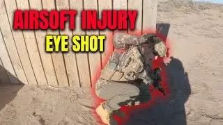 Airsofter Shot in the Eye — Even With Eye Protection
