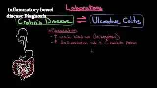 24  Inflammatory bowel disease Diagnosis Viet