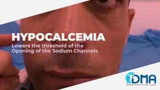 CHVOSTEK'S SIGN I SEMIOPEDIA: PATHOPHYSIOLOGY OF MEDICAL SEMIOTICS I DR.P.HARINATH I DMA, CHENNAI