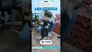 KIDS WITH OUT LEGS         //Hip Disarticulation And Above Knee Prosthesis (Child Prosthesis)