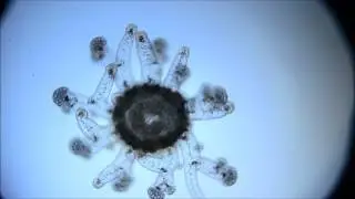 Hydroid medusa micro