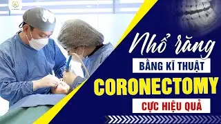 Coronectomy - Kỹ Thuật Nhổ Răng Khôn An Toàn, Không Đau, Nhanh Chóng | Bác sĩ Trung Long Biên
