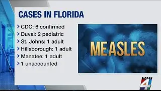 Local measles cases highlight tension over exemptions as lawmaker seeks to expand vaccine opt outs