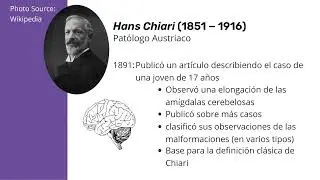 &iquest;Qu&eacute; es Chiari?