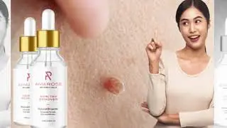 Amarose Skin Tag Remover Reviews -BEWARE Ingredients And Side Effects Exposing Reports!