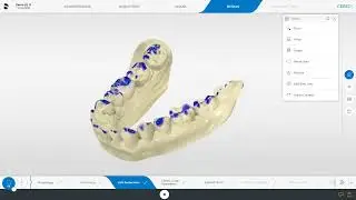 CEREC SW 5 - Digital Chairside Implant Workflow (1/5)