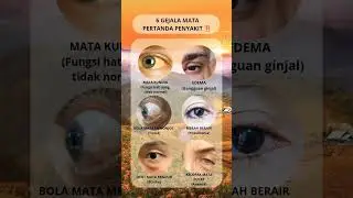 pertanda penyakit yg dpat dilihat dri mata,#mata #sehat #tips #hidupsehat #penyakit #kesehatan