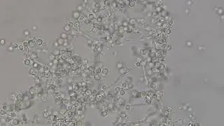 Yeast cells, budding yeasts and pseudohyphae