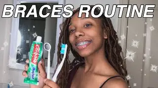 MY BRACES ROUTINE