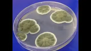 Wellness Talk | IS MOLD CONTAMINATION IN YOUR HOME DESTROYING YOUR HEALTH? The Mold Medic!