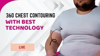 Dr. Anirban Ghosh is live! with 360 chest contouring with advanced liposuction technology