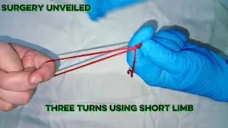 Roeder&rsquo;s Knot Made Easy clear demonstration | surgery unveiled
