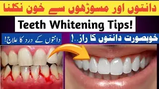 #1 Best Toothpaste For Teeth Whitening|Dant dard ka ilaj|Dant Saaf Kaise kre|Teeth whitening|Scaling