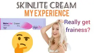 SKINLITE CREAM really get fairness? # my experience in skinlite cream @kosjayrafamily96
