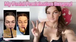 My Facial Feminization Surgery!