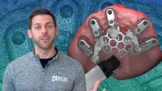 The Freehand Surgery - Grammetry Relationship