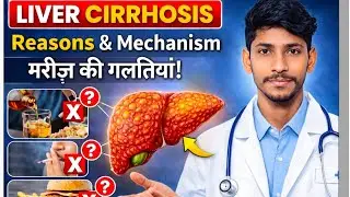 Liver Cirrhosis: Patient Ki Galtiyan, Reasons Aur Mechanism | Liver Damage Explained
