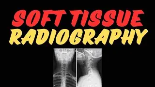 Soft tissue Radiography| low kVp techniques | x ray soft tissue nasopharynx | mammography |