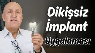 Dikişsiz İmplant Uygulaması | Prof. Dr. &Ouml;mer Kutay - Implant
