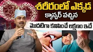 శరీరంలో కాన్సర్ ని ఇలా గుర్తించండి, మొదట కనిపించే లక్షణం ఇదే | Dr Mohan Vamsi About Cancer symptoms