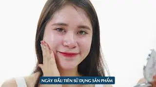 KEM FACE - WHITENING FACE CREAM