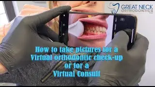 How to take pictures for a virtual orthodontic check-up or virtual consultation!