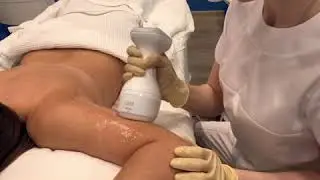 ULFIT-терапия в клинике Beauty Trend