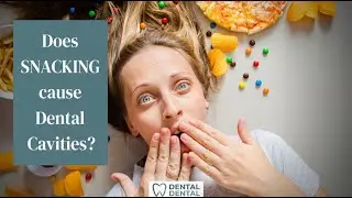 Does Snacking Cause Dental Cavities? Explained by a Dentist!