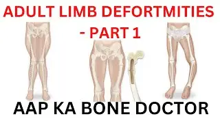 ADULT LIMB DEFORMITY AND CORRECTION - PART 1- EPISODE 52