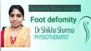 Physiotherapy treatment of operated Pes cavus #deformity correction