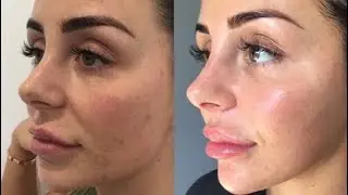 10 PROVEN TIPS FOR NATURALLY GLOWING SKIN | skincare diary