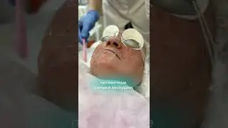 ⚡LUMENIS М22 (IPL)⚡