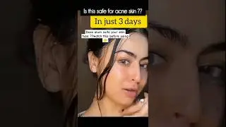 Don't do this mistake ❌ alum for face 👀 alum stone #shorts #youtubeshorts